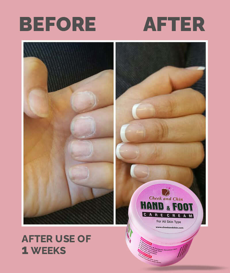 Special Hand and Foot Whitening cream